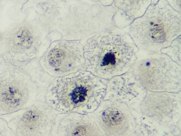 White Fish Mitosis Slides - White Fish Mitosis 09 400X